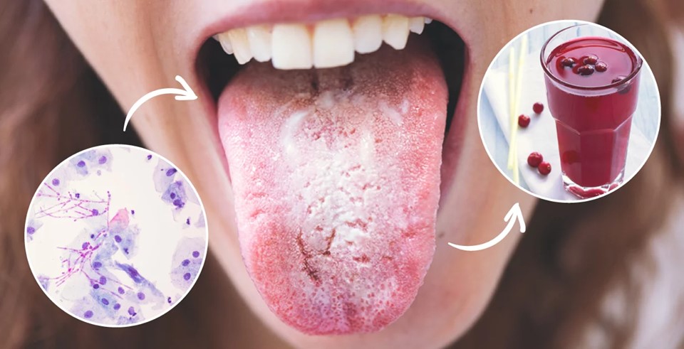 65085752_2770456289696504_6248038905749176320_n