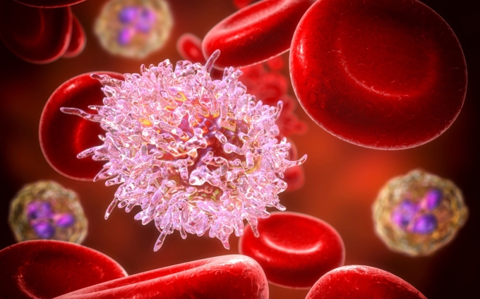 leucemia-tipo-cancer-afecta-sangre_0_18_800_498