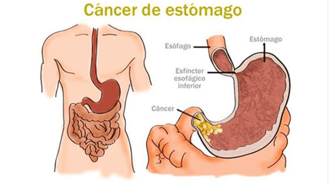 Captura-de-pantalla-2019-03-28-a-las-07.57.51