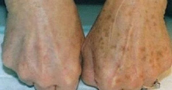 140cdbfdbe945c0776923502178344e0