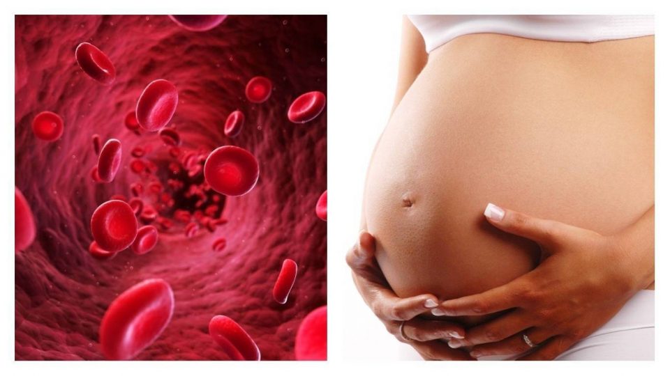 anemia-en-el-embarazo-
