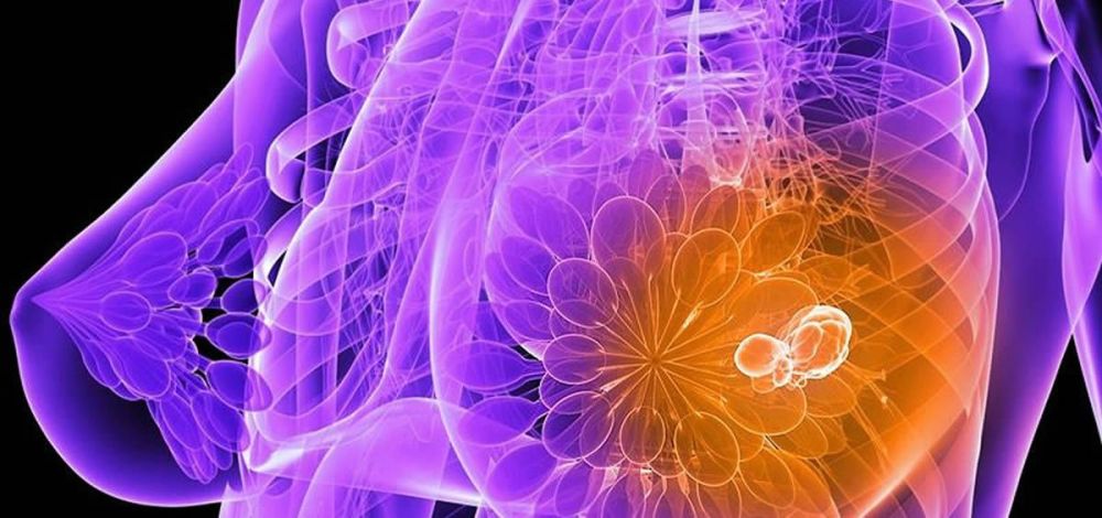 la-fundacion-isys-analiza-las-aplicaciones-moviles-sobre-cancer-de-mama