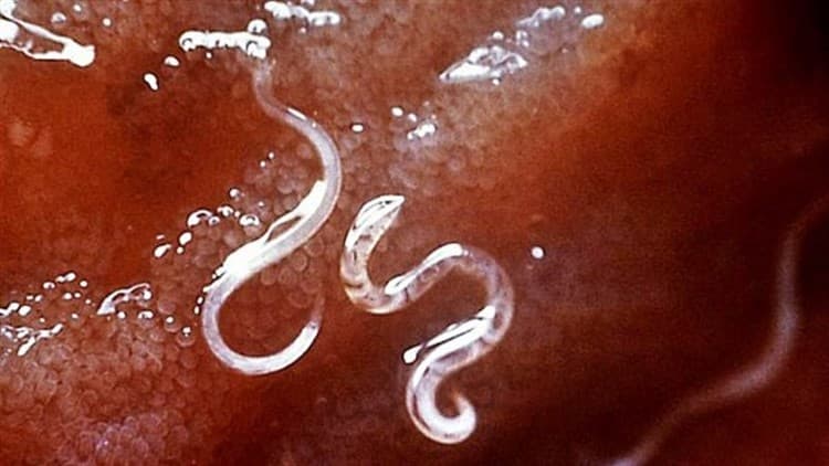 parasitosintestinales